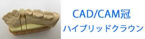 CAD/CAM冠ハイブリッドクラウン