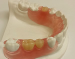 ●義歯・入れ歯治療ページ