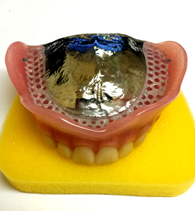 自由診療（自費診療）の入れ歯